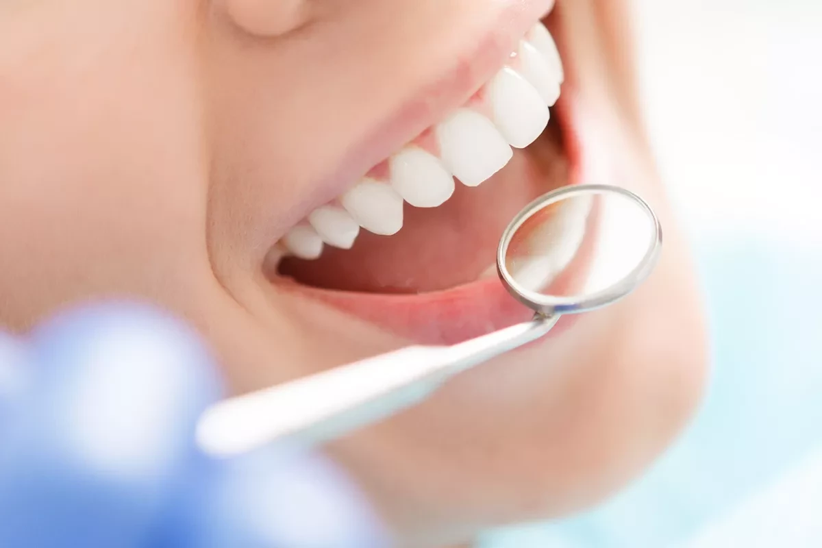 Нужно ли лечить все зубы перед имплантацией что важно знать?