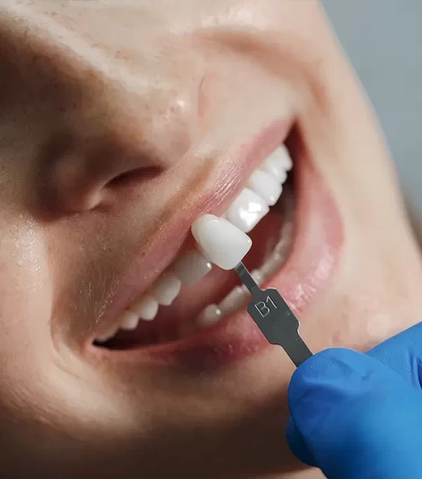 Как отбелить зубы: доступные цены и лучшие методы